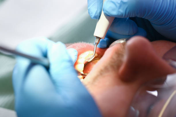 Best Dental Abscess Treatment in Refugio, TX