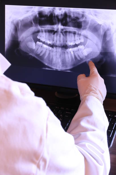 Best Emergency Dental Care for Sports Injuries in Refugio, TX